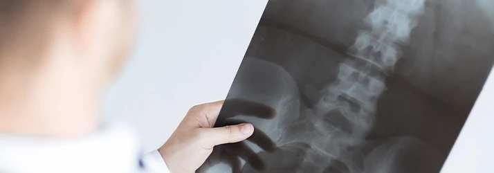 Chiropractic Council Bluffs IA Doctor with X Rays